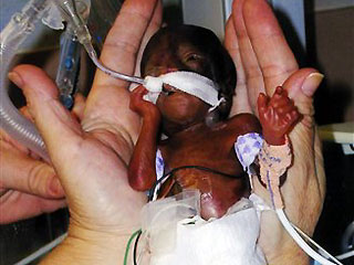 Babies born early